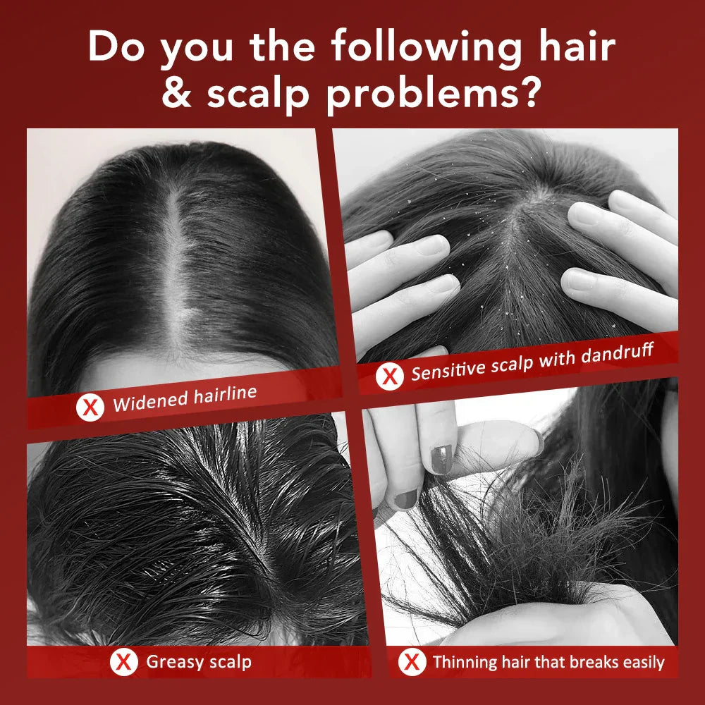 Electric Scalp Massage Comb Red Light