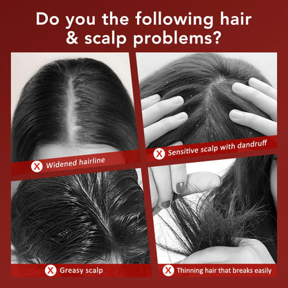 Electric Scalp Massage Comb Red Light